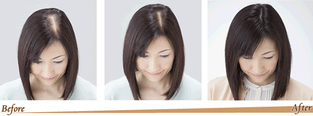 増毛とは 女性用かつら ウィッグ 増毛 育毛 ヘアコンタクトならプロピアレディース